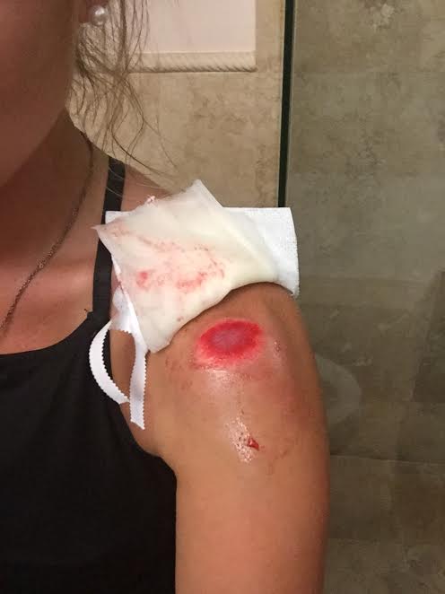 AlyssaRamomsuglysidebooboo